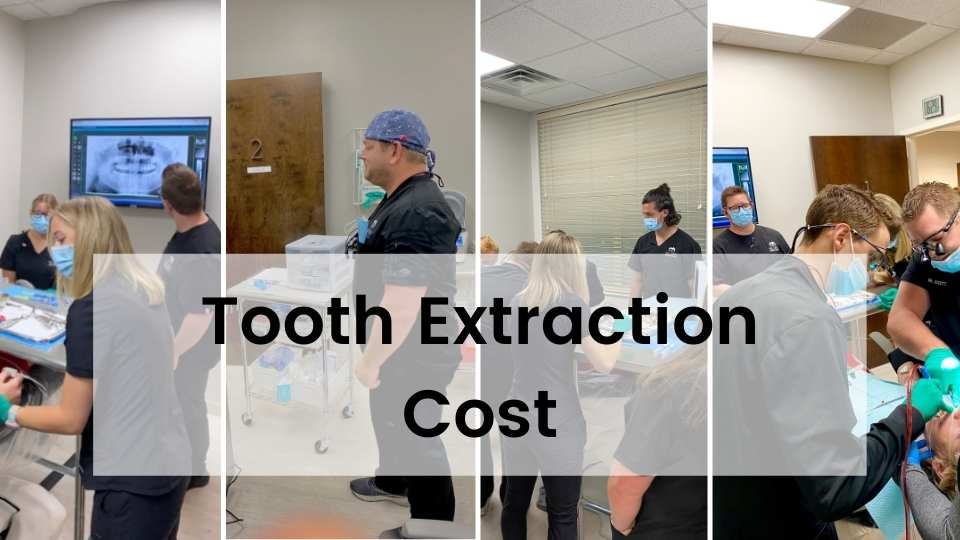 Tooth Extraction Cost