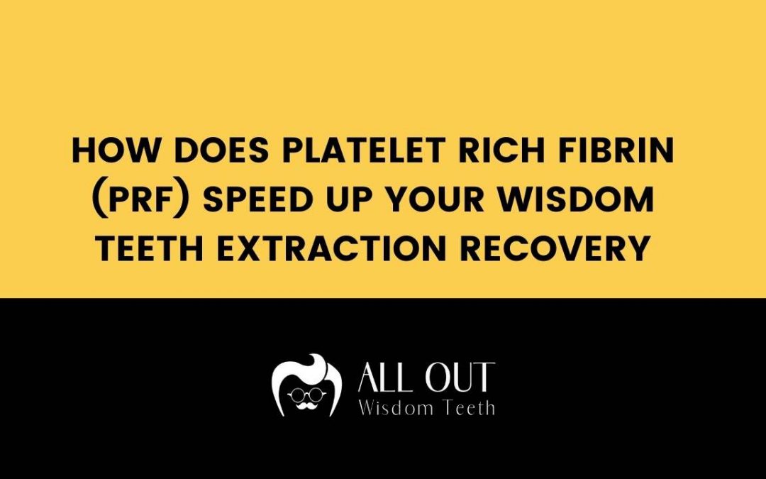How does Platelet Rich Fibrin (PRF) speed up your Wisdom Teeth Removal